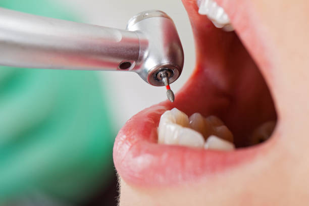 Best Tooth Infection Emergency Dentist  in Mahtomedi, MN